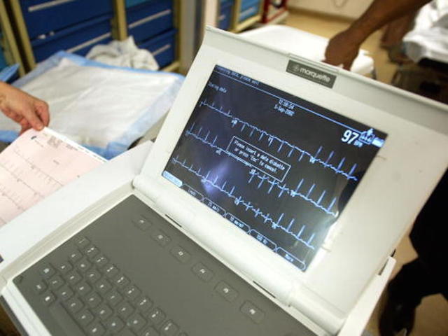NEW YORK - SEPTEMBER 5: A nurse prints out an EKG monitor reading in the emergency room at Coney Island Hospital September 5, 2002 in the Brooklyn borough of New York City. The public hospital serves a large multi-ethnic patient population including many Russians, Pakistanis and Central Americans residing in the South Brooklyn area. The emergency room receives approximately 60,000 patients each year. (Photo by Mario Tama/Getty Images)